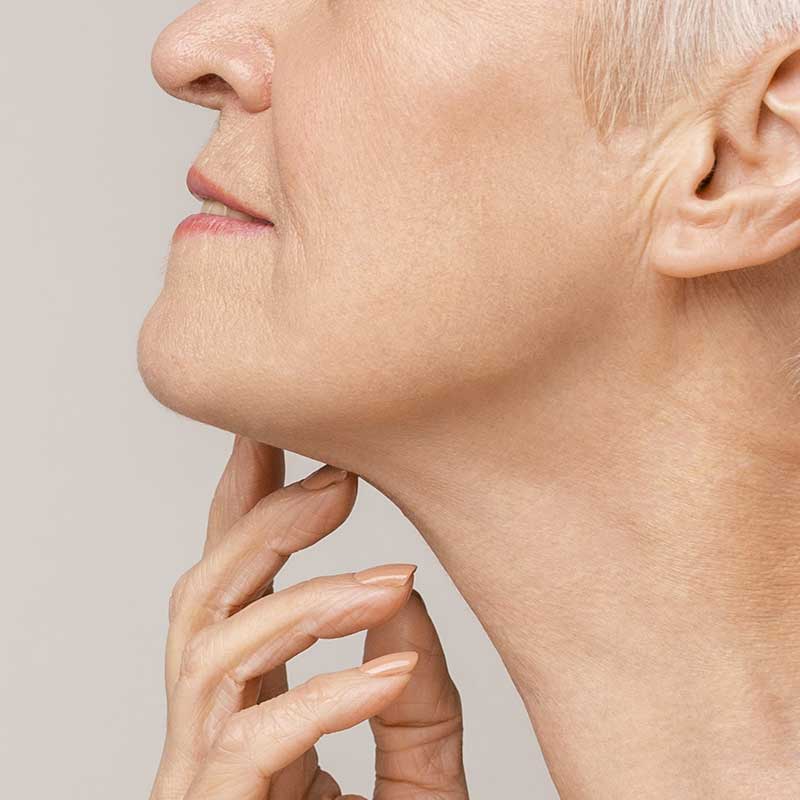 Woman representing ResurFX patient